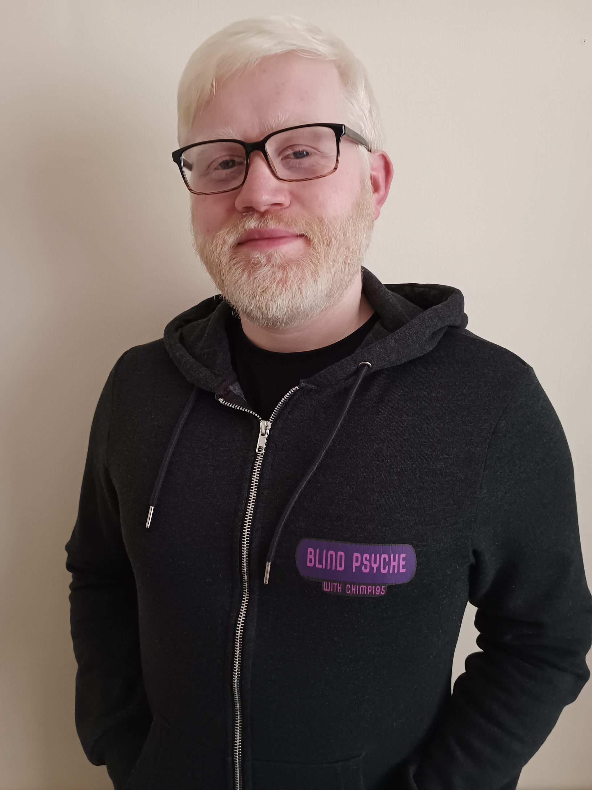 Picture of an albino man in a black hoodie